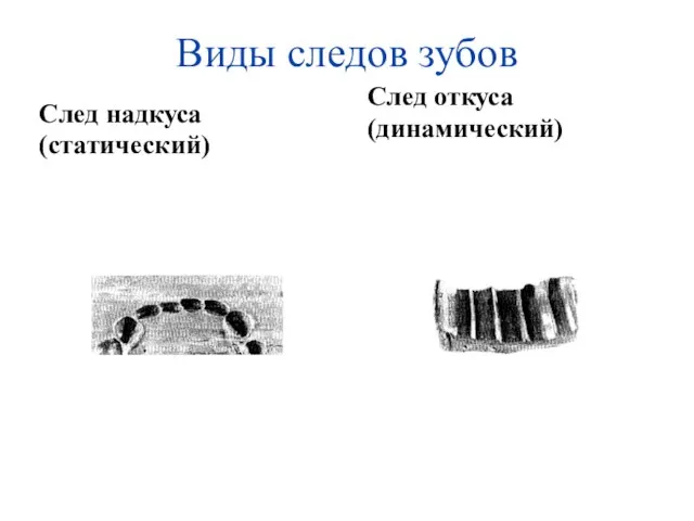 Виды следов зубов След надкуса (статический) След откуса (динамический)