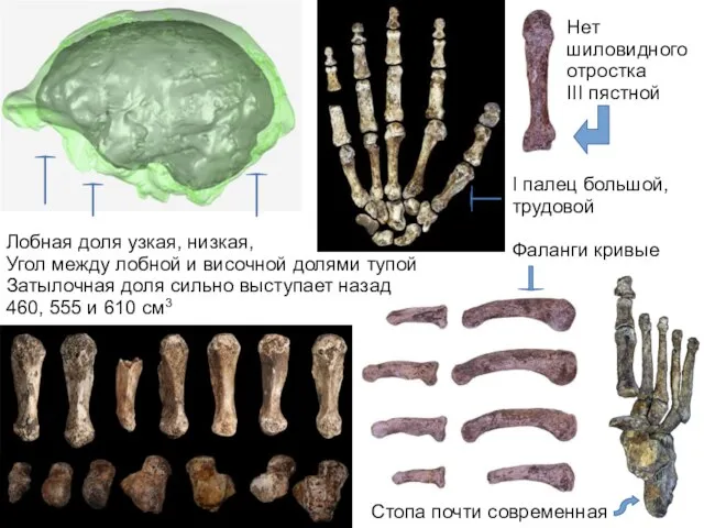 Лобная доля узкая, низкая, Угол между лобной и височной долями тупой Затылочная