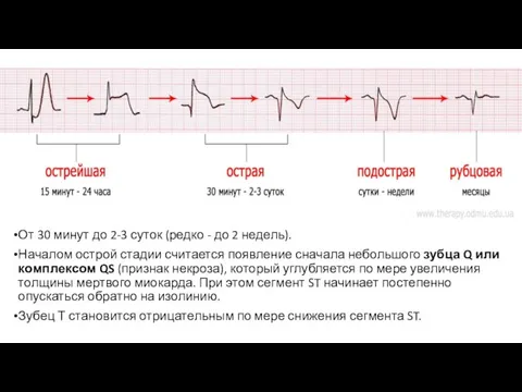 От 30 минут до 2-3 суток (редко - до 2 недель). Началом