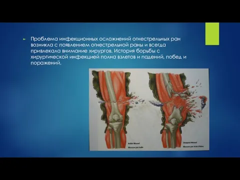 Проблема инфекционных осложнений огнестрельных ран возникла с появлением огнестрельной раны и всегда