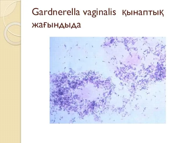 Gardnerella vaginalis қынаптық жағындыда