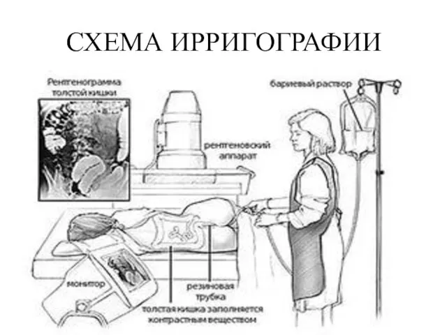 СХЕМА ИРРИГОГРАФИИ