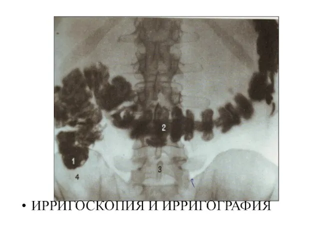 ИРРИГОСКОПИЯ И ИРРИГОГРАФИЯ