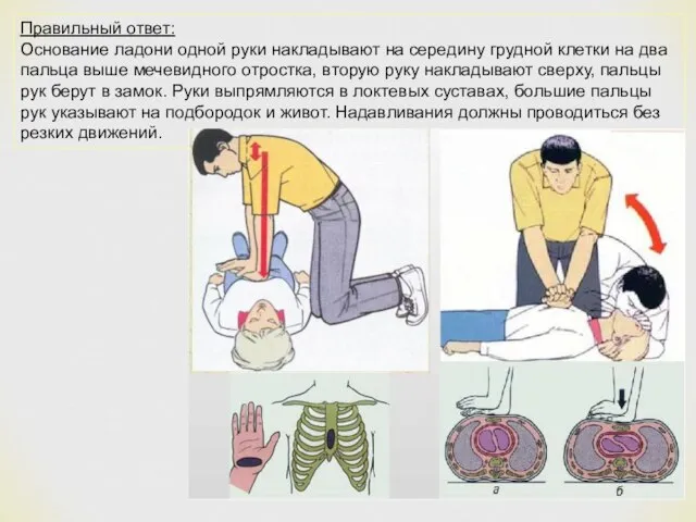 Правильный ответ: Основание ладони одной руки накладывают на середину грудной клетки на