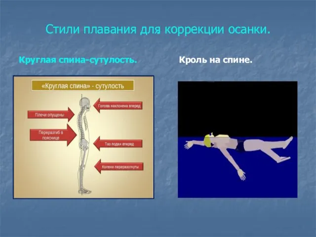 . Круглая спина-сутулость. Кроль на спине. Стили плавания для коррекции осанки.