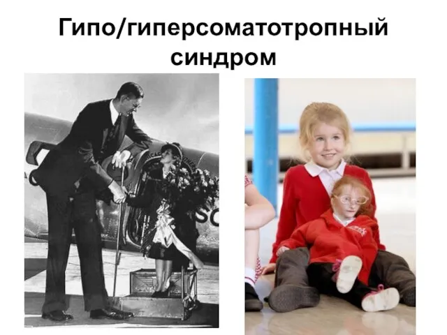 Гипо/гиперсоматотропный синдром