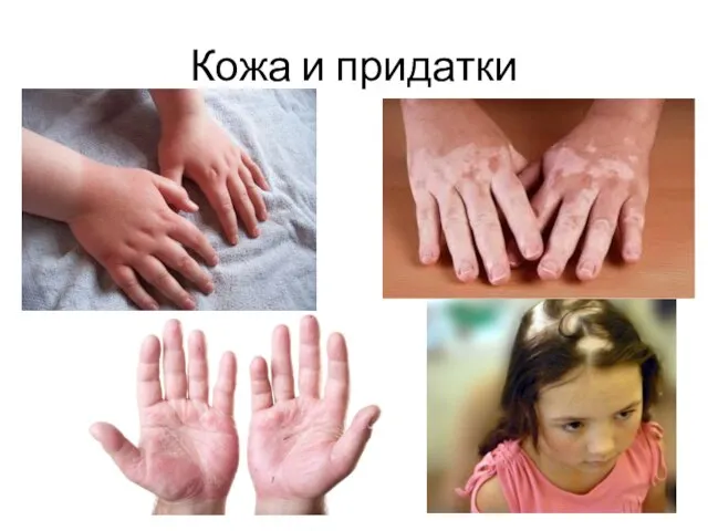 Кожа и придатки