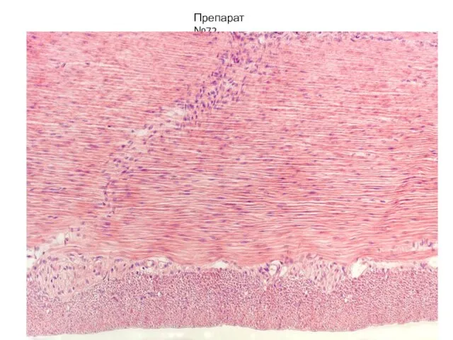Препарат №72