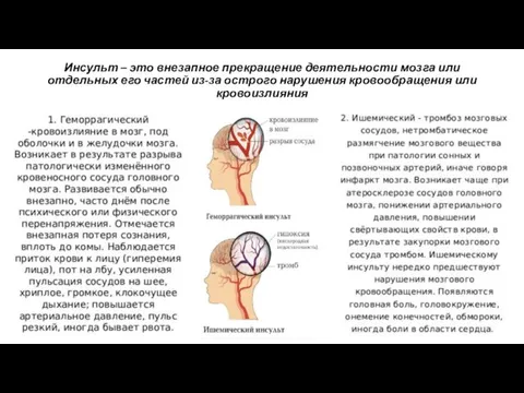 Инсульт – это внезапное прекращение деятельности мозга или отдельных его частей из-за