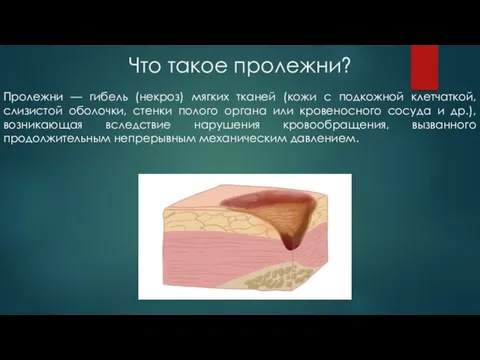 Что такое пролежни? Пролежни — гибель (некроз) мягких тканей (кожи с подкожной