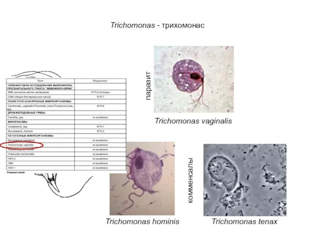 Trichomonas - трихомонас Trichomonas vaginalis Trichomonas tenax Trichomonas hominis паразит комменсалы
