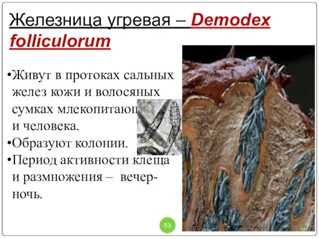 Железница угревая – Demodex folliculorum Живут в протоках сальных желез кожи и