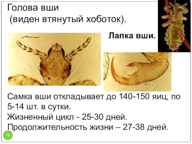 Голова вши (виден втянутый хоботок). Лапка вши. Самка вши откладывает до 140-150