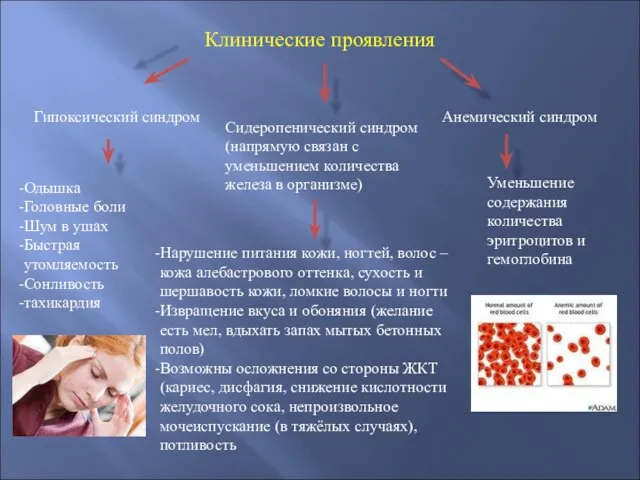 Клинические проявления Гипоксический синдром Сидеропенический синдром (напрямую связан с уменьшением количества железа