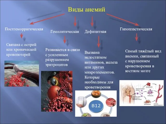 Виды анемий Постгеморрагическая Гемолитическая Дефицитная Гипопластическая Связана с острой или хронической кровопотерей