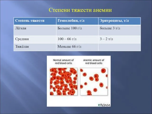 Степени тяжести анемии