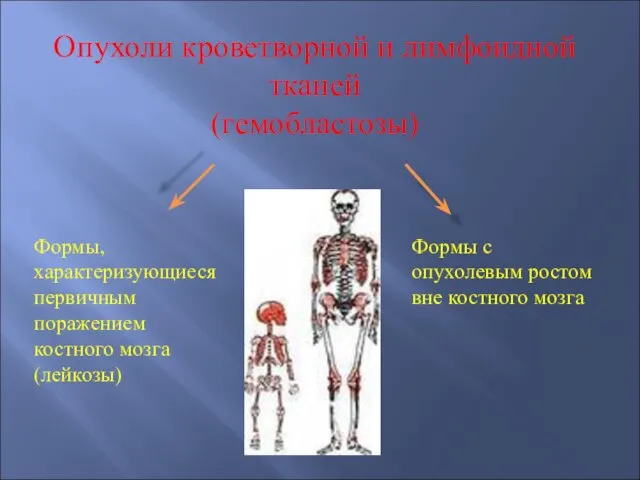 Опухоли кроветворной и лимфоидной тканей (гемобластозы) Формы, характеризующиеся первичным поражением костного мозга