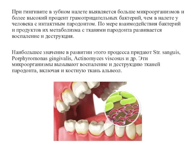 При гингивите в зубном налете выявляется больше микроорганизмов и более высокий процент