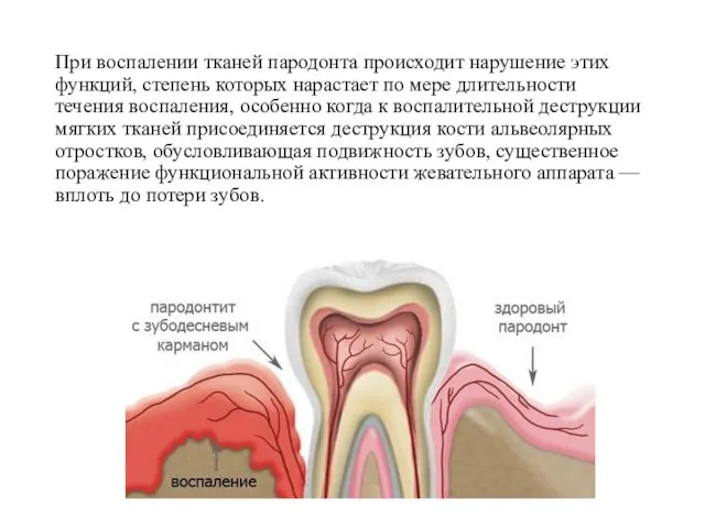 При воспалении тканей пародонта происходит нарушение этих функций, степень которых нарастает по