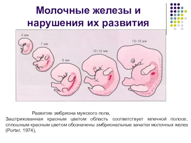 Молочные железы и нарушения их развития Развитие эмбриона мужского пола, Заштрихованная красным