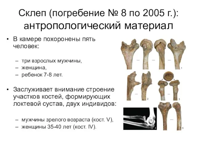 Склеп (погребение № 8 по 2005 г.): антропологический материал В камере похоронены