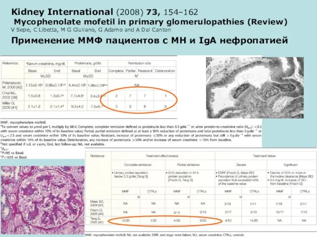 Применение ММФ пациентов с МН и IgA нефропатией Kidney International (2008) 73,