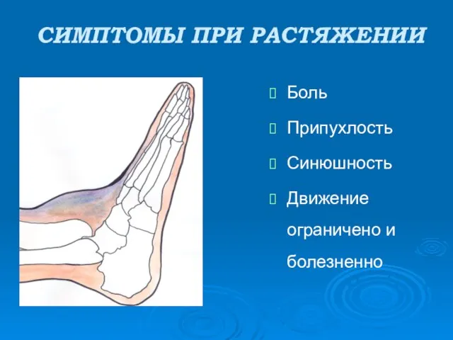 СИМПТОМЫ ПРИ РАСТЯЖЕНИИ Боль Припухлость Синюшность Движение ограничено и болезненно