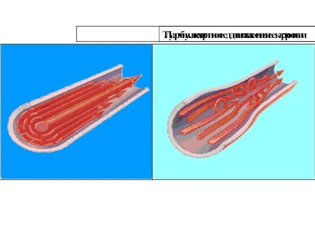 Ламинарное движение крови Турбулентное движение крови