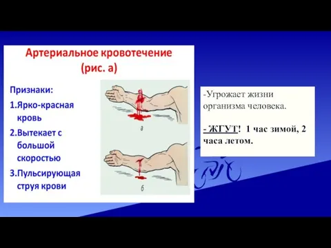 -Угрожает жизни организма человека. - ЖГУТ! 1 час зимой, 2 часа летом.