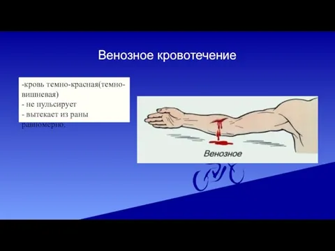 Венозное кровотечение -кровь темно-красная(темно-вишневая) - не пульсирует - вытекает из раны равномерно.