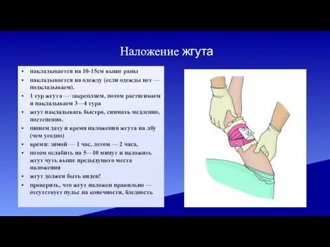 Наложение жгута накладывается на 10-15см выше раны накладывается на одежду (если одежды