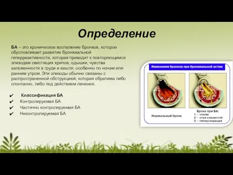 Определение БА – это хроническое воспаление бронхов, которое обусловливает развитие бронхиальной гиперреактивности,