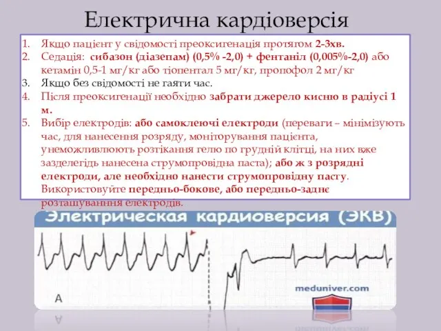 Електрична кардіоверсія Якщо пацієнт у свідомості преоксигенація протягом 2-3хв. Седація: сибазон (діазепам)