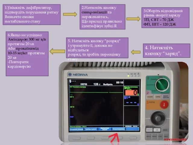 1.Увімкніть дефібрилятор, підтвердіть порушення ритму Визначте ознаки нестабільного стану 2.Натисніть кнопку синхронізації