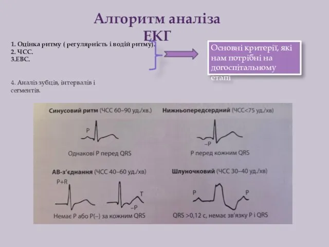 Алгоритм аналіза ЕКГ 1. Оцінка ритму ( регулярність і водій ритму). 2.