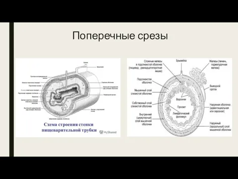 Поперечные срезы