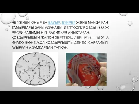 НЕГІЗІНЕН, ОНЫМЕН БАУЫР, БҮЙРЕК ЖӘНЕ МАЙДА ҚАН ТАМЫРЛАРЫ ЗАҚЫМДАНАДЫ. ЛЕПТОСПИРОЗДЫ 1888 Ж.