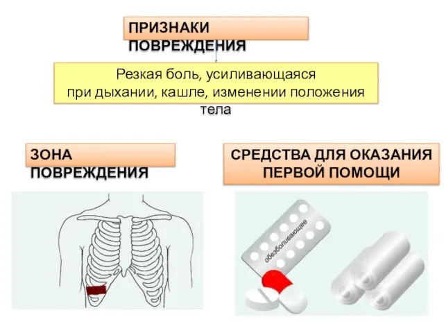 ПРИЗНАКИ ПОВРЕЖДЕНИЯ Резкая боль, усиливающаяся при дыхании, кашле, изменении положения тела ЗОНА