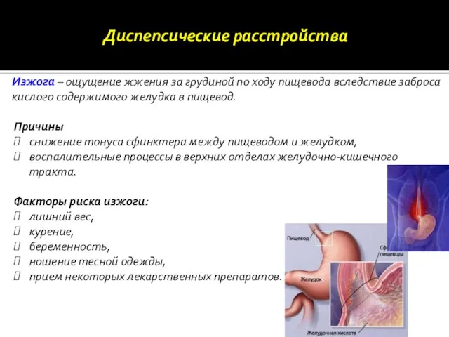 Изжога – ощущение жжения за грудиной по ходу пищевода вследствие заброса кислого