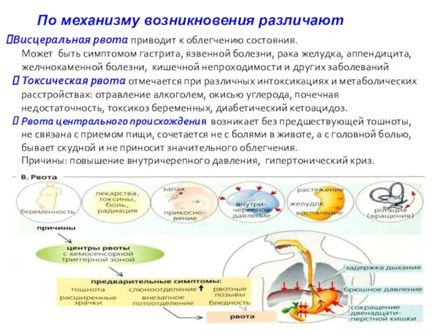 По механизму возникновения различают Висцеральная рвота приводит к облегчению состояния. Может быть