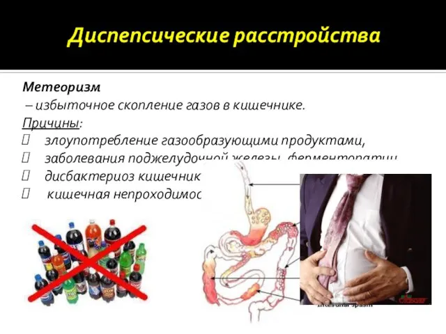 Метеоризм – избыточное скопление газов в кишечнике. Причины: злоупотребление газообразующими продуктами, заболевания