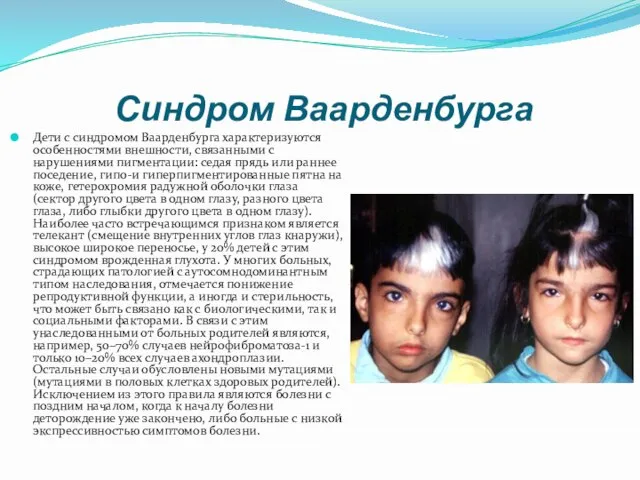Синдром Ваарденбурга Дети с синдромом Ваарденбурга характеризуются особенностями внешности, связанными с нарушениями