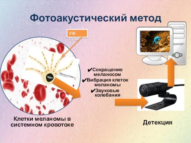 Фотоакустический метод Клетки меланомы в системном кровотоке Сокращение меланосом Вибрация клеток меланомы Звуковые колебания Детекция УФ-лучи