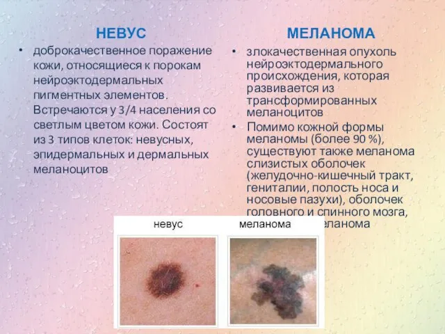 НЕВУС доброкачественное поражение кожи, относящиеся к порокам нейроэктодермальных пигментных элементов. Встречаются у