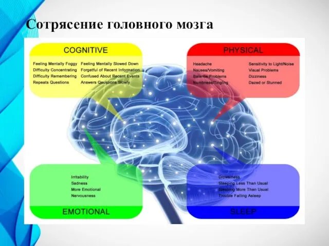 Сотрясение головного мозга