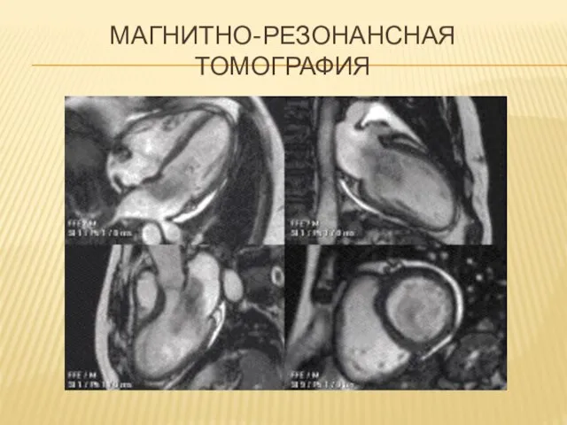 МАГНИТНО-РЕЗОНАНСНАЯ ТОМОГРАФИЯ