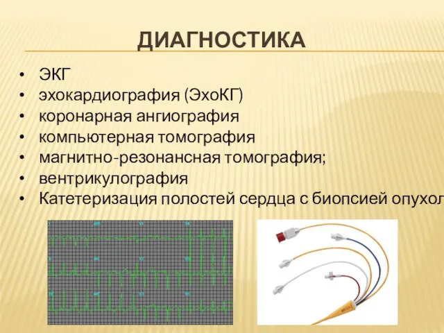 ДИАГНОСТИКА ЭКГ эхокардиография (ЭхоКГ) коронарная ангиография компьютерная томография магнитно-резонансная томография; вентрикулография Катетеризация