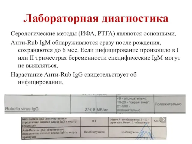 Лабораторная диагностика Серологические методы (ИФА, РТГА) являются основными. Анти-Rub IgM обнаруживаются сразу