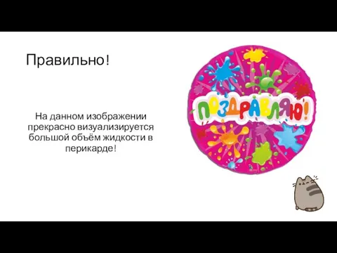 Правильно! На данном изображении прекрасно визуализируется большой объём жидкости в перикарде!