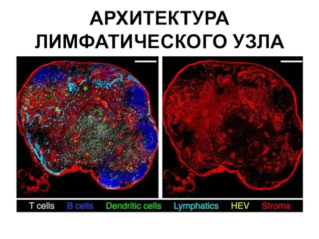 АРХИТЕКТУРА ЛИМФАТИЧЕСКОГО УЗЛА